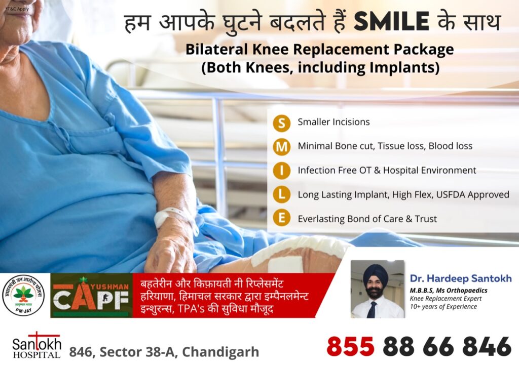 Bilateral Knee Replacement Package by SMILE technique using Smaller cuts, Minimal Tissue loss and Blood Loss using Long Lasting implants
