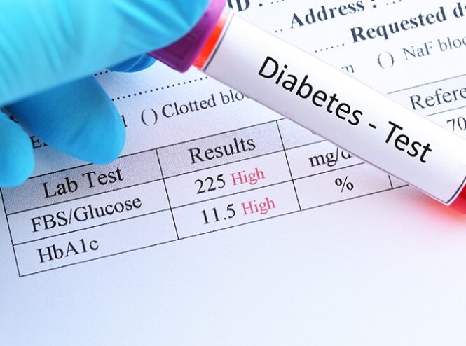 A Comprehensive Review of Diabetes Test