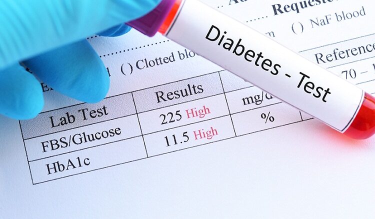 A Comprehensive Review of Diabetes Test